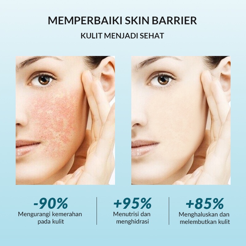 BIOAQUA 7X Ceramide Skin Barrier Repair Moisturize Emulsion Face Lotion 30ml For All Skin Types Memperbaiki Skin Barrier yang Rusak