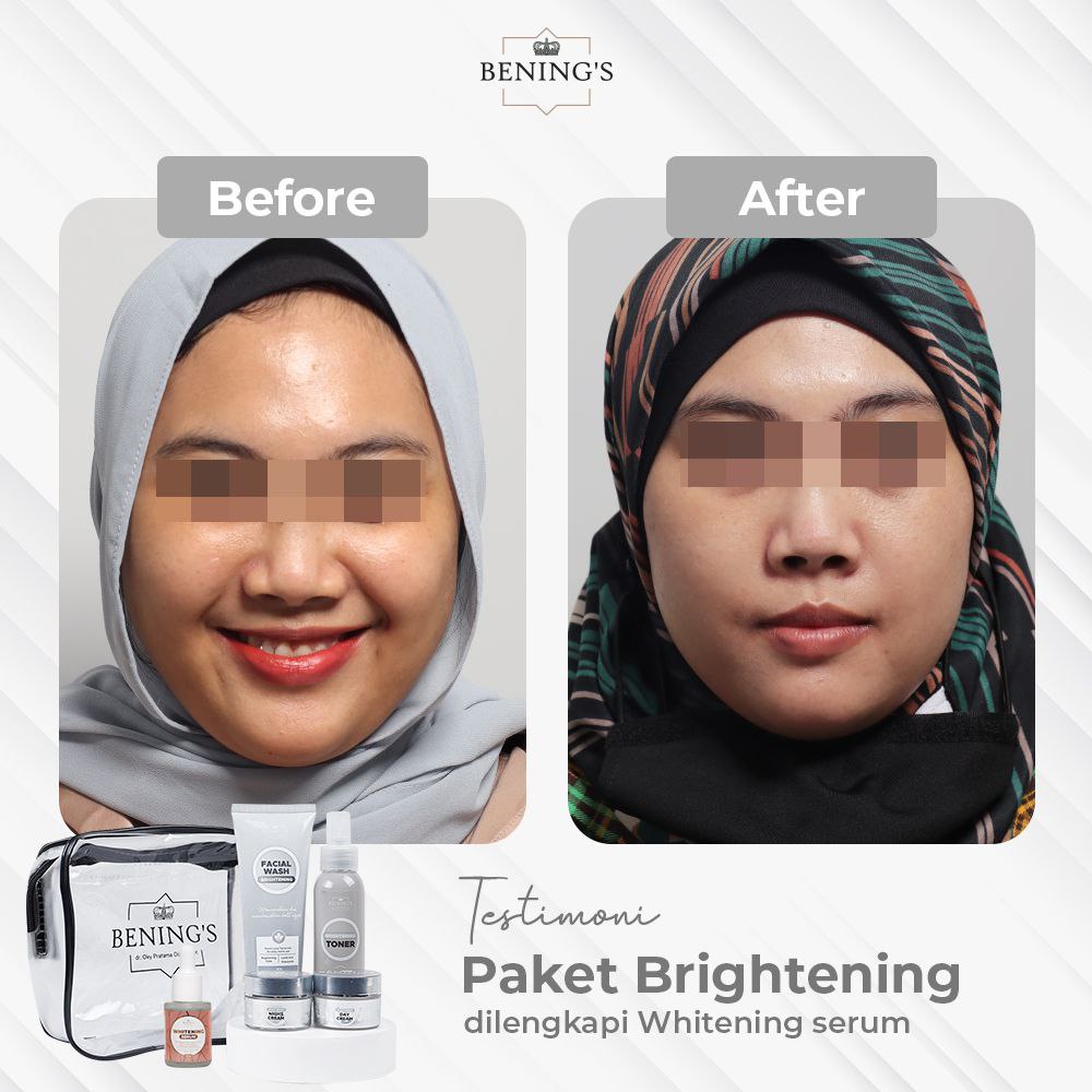 Paket Skincare Brightening Bening Skincare Dr Oky Pratama Pencerah Pembersih Pemutih Wajah Perawatan Kecantikan Termurah Premium