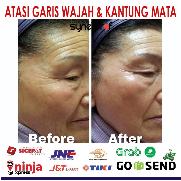 Pemutih Wajah BPOM Terbaik | Trulum Pemutih Wajah Paling Cepat & Aman