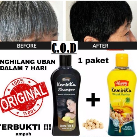 SEPAKET SHAMPO+MINYAK RAMBUT KEMIRIKU VIT.E PENUMBUH RAMBUT BOTAK/PENGHILANG UBAN 100% ORI BPOM