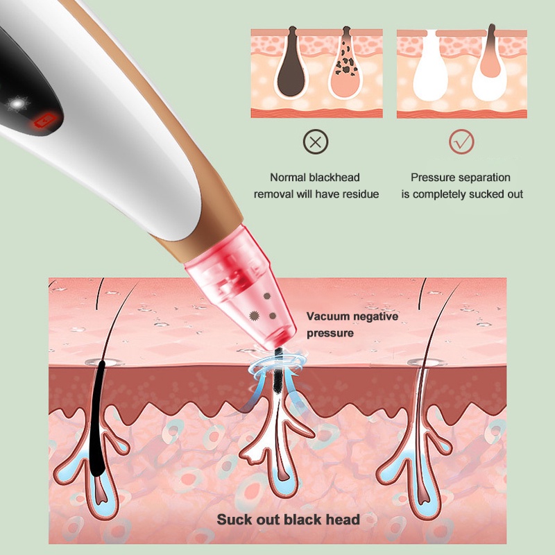 Wajah Lampu LED Terapi Penghilang Komedo Vacuum Pore Cleaner Heating Massage Skin Care 5in1 Alat Penyedot Komedo