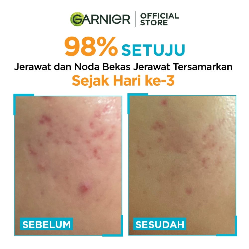 Garnier Bright Complete Anti Acne Serum 15ml