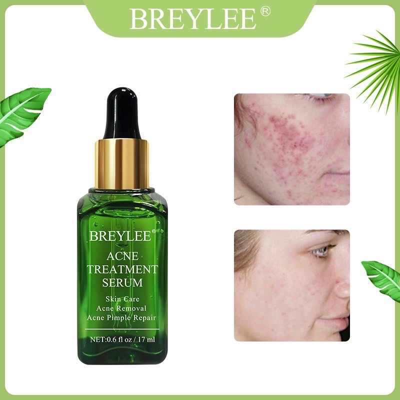 Breylee Penghilang Jerawat serum wajah acne pemutih kulit wajah skincare 17ml