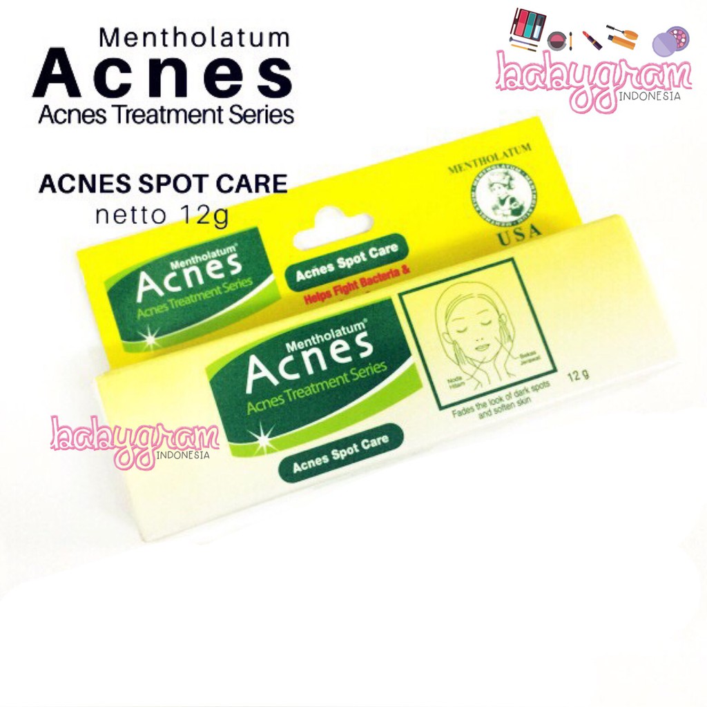 ORIGINAL Acnes Spot Care 12g / 12 gram Krim Jerawat Muka Wajah Rohto