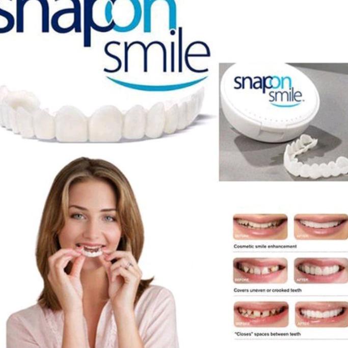 ֎ Snap On Smile Gigi Palsu 1 Set Atas Bawah - Gigi Palsu Silikon grosir