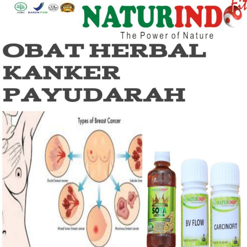 Obat Herbal Kanker Payudara  Obat Herbal kanker Obat Atasi Kanker