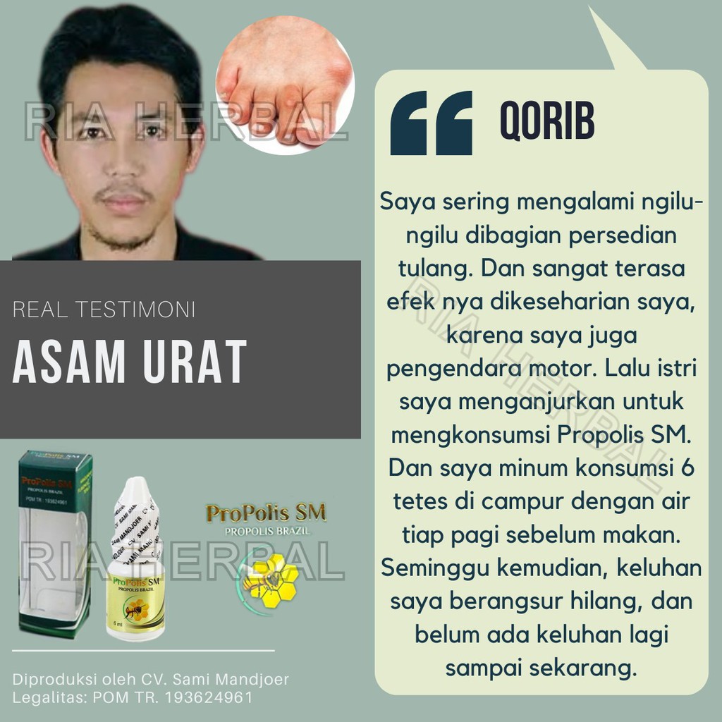 Obat Jari Tangan Kaku Dan Sakit, Obat Triger Finger, Obat Jari Susah Ditekuk, Obat Jari Susah Digerakan, Obat Sakit Telapak Tangan, Obat Telapak Tangan Dan Kaki Kebas Kesemutan, Obat Jari Pelatuk Dengan ProPolis SM