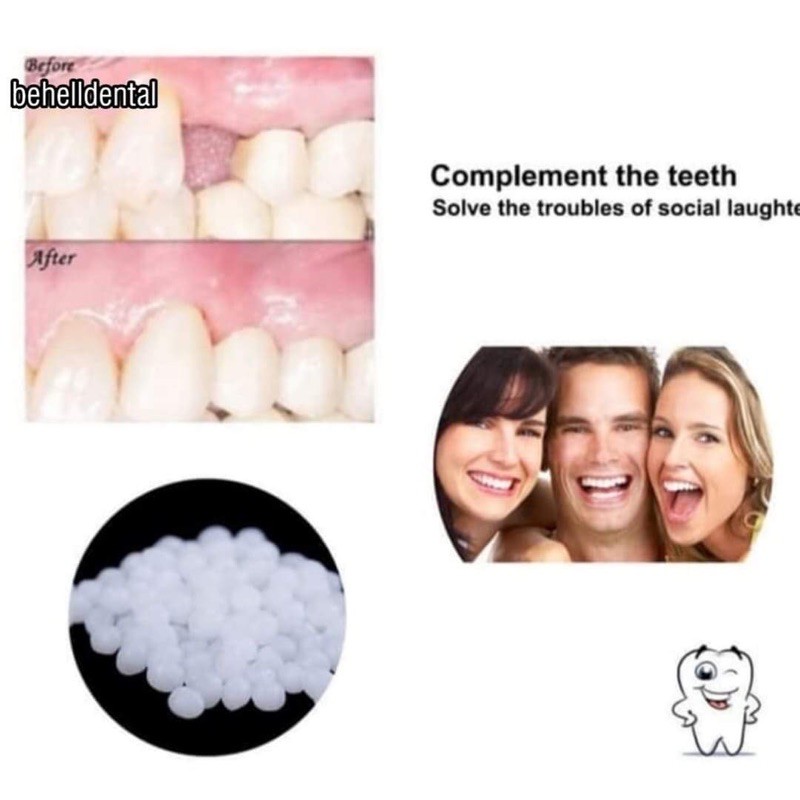 GIGI PALSU SEMENTARA 200 BUTIR / PENAMBAL GIGI PATAH RENGGANG TEMPORARY TOOTH TEMPTOOTH GINGSUL PATAH KELINCI / Snap On Smile Instan / Bahan Tambal Tambalan Lem Gigi Tiruan / Temporary Tooth Lem Gigi Original