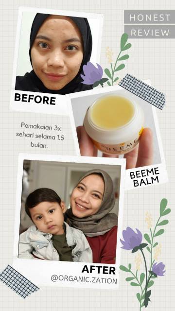 Paket Buddle Beeme Healing balm 15gr &amp; Beeme Suncreen 25gr | Skincare Bayi Dan Anak