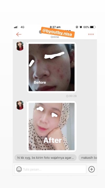 NEW ACNE GLOWING KRIM MALAM BEKAS JERAWAT BOPENG WHITENING CREAM PEMUTIH WAJAH BPOM BUMIL BUSUI ORI