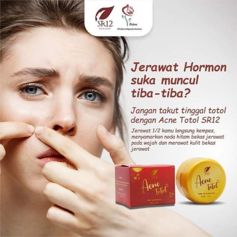 

Acne Totol SR12,,,Ampuh hempas Jerawat!!