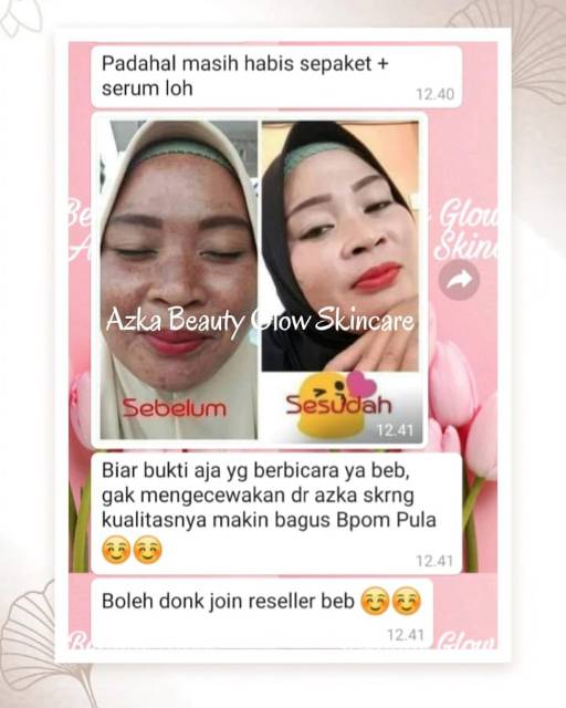 THERAZKA PAKET FLEK DOUBLE GLOW KINCLONG (DAY AHA)