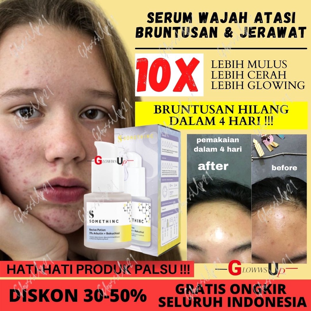 Serum Wajah Penghilang Bruntusan Dan Bekas Jerawat SOMETHINC Revive Potion 3% Arbutin + Bakuchiol Serum Jerawat Dan Bruntusan Perawatan Wajah