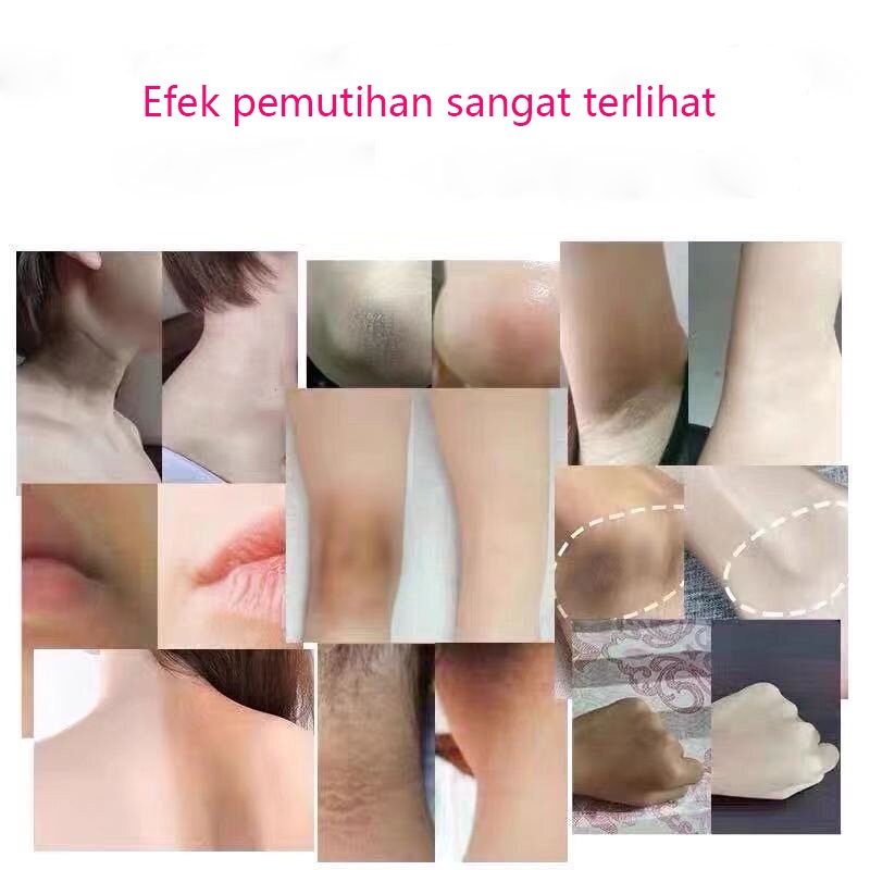 Krim Pemutih Memutihkan Bagian Pribadi Pemutih Ketiak 60g Lembut Dan Tak Ada Iritasi Menghilangkan Kusam Kulit Membuat Kulit Jadi Halus