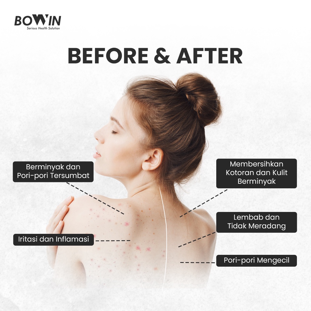 Bowin Back &amp; Chest Acne Spray - Maskne (Centella Asiatica&amp;Allantoin) [Jerawat Wajah, Jerawa Punggung, Jerawat Tubuh, Jerawat Dada}