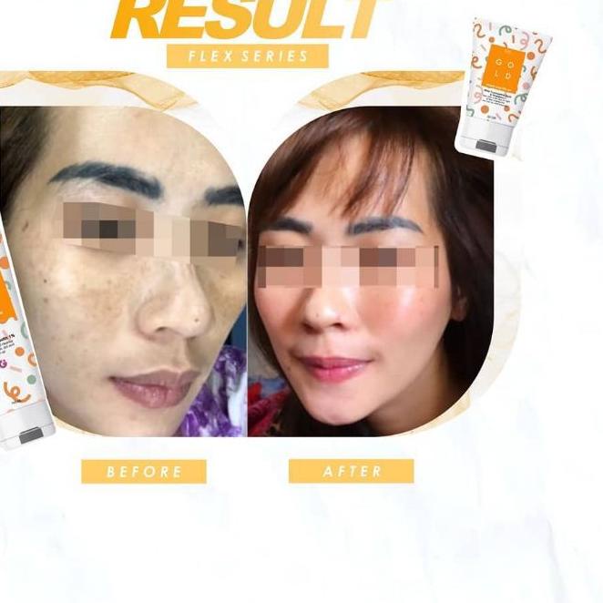 ✵ READY GLAFIDSYA SKIN - Paket FLEK Original Reseller Resmi Surabaya ✹