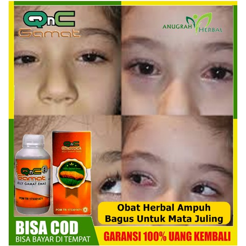 Obat Mata Juling Mata Perih Mata Belekan Mata Minus Testimoni Qnc Jelly Gamat Indonesia