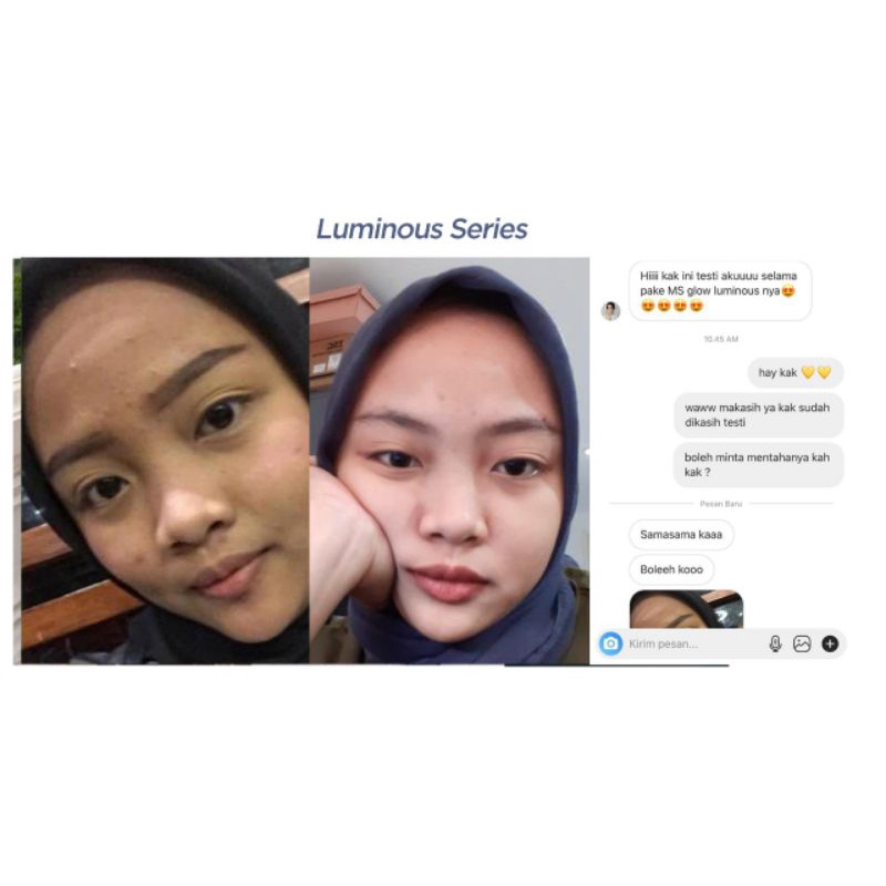 MS Glow Paket Wajah Luminous Series / Perawatan Wajah Bekas Noda Jerawat Ms Glow-5