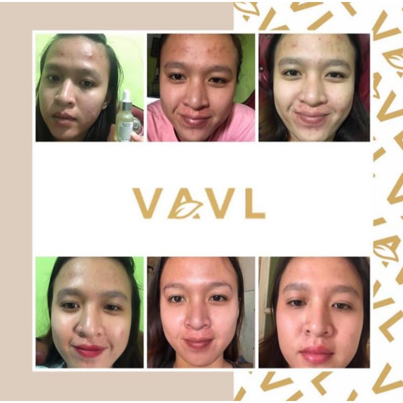 VAVL TERLARIS paket beauty water + blemish serum + free gift