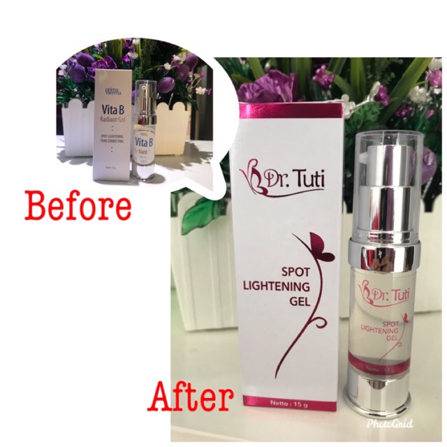 Serum whitening vitab radiant ganti ( spot ligtening gel)