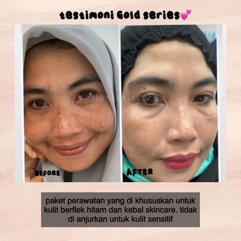 (Pusat Jawa)Daviena Skincare|GOLD SERIES|PEMUTIH WAJAH BPOM DAVIENA SKINCARE|DAVINA SKINCARE