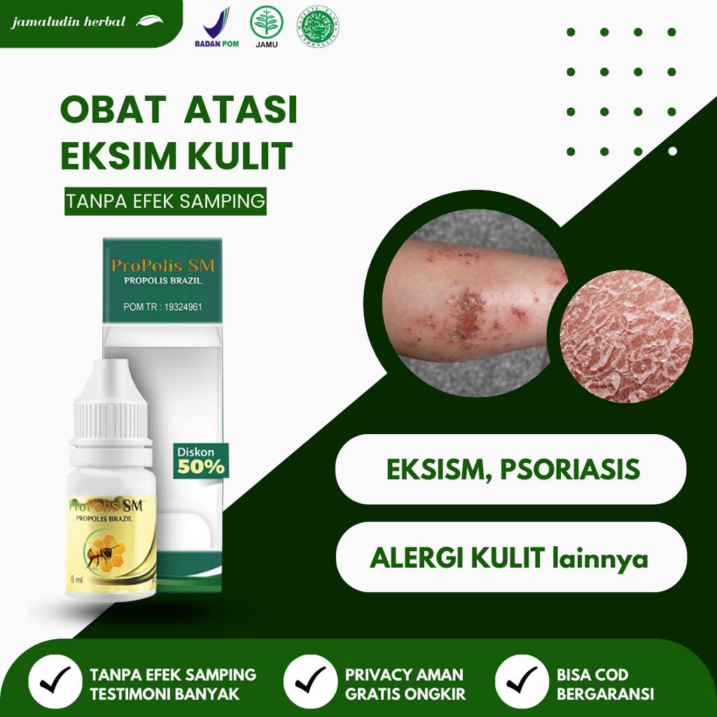 PROPOLIS SM - Obat Eksim Gatel Gatal Kulit Jamur Herbal - Obat Kulit Herbal - Obat Gatal - Obat Luka