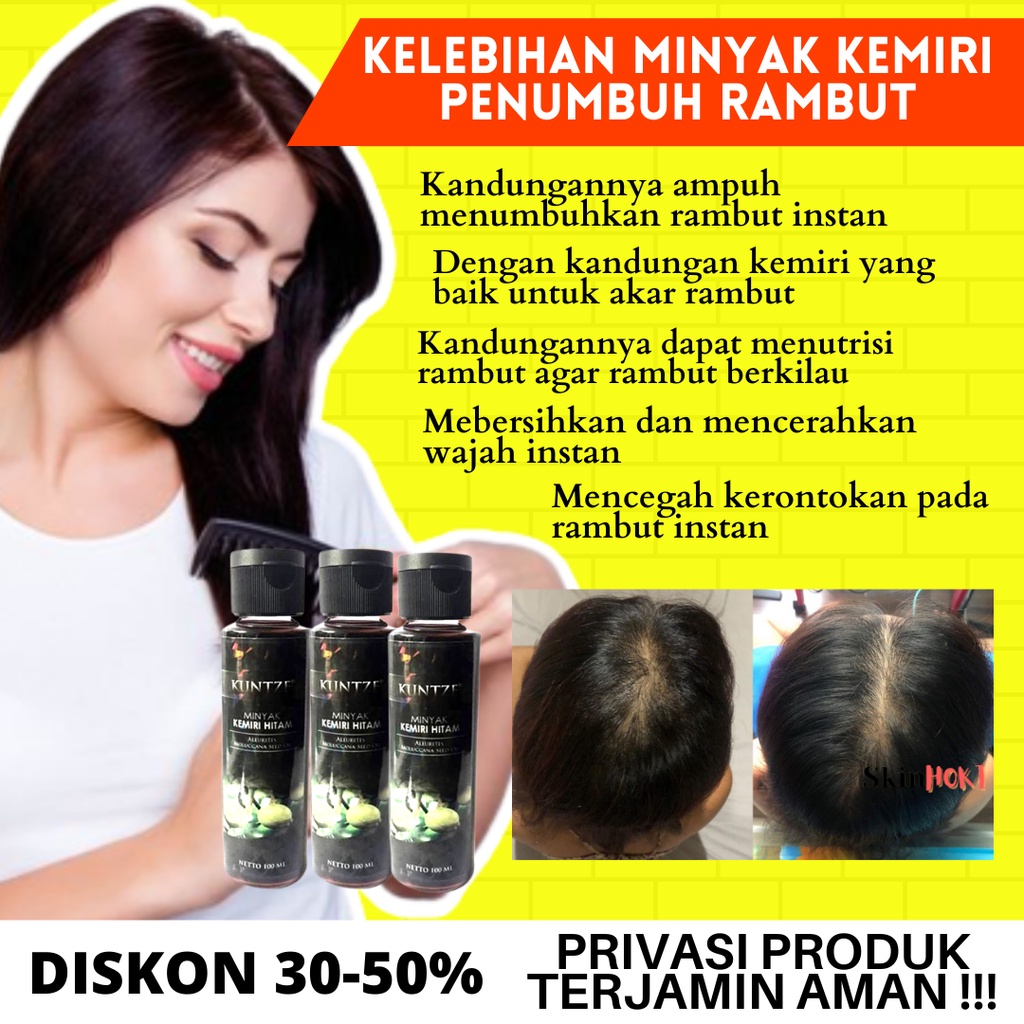 MINYAK KEMIRI PENUMBUH RAMBUT PENGHITAM ALIS MINYAK KEMIRI HITAM KUNTZE 100ML PENGHITAM RAMBUT ORIGINAL BPOM
