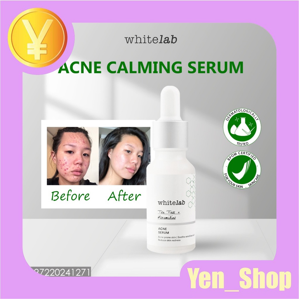 WHITELAB ACNE CALMING SERUM serum anti acne 100% original