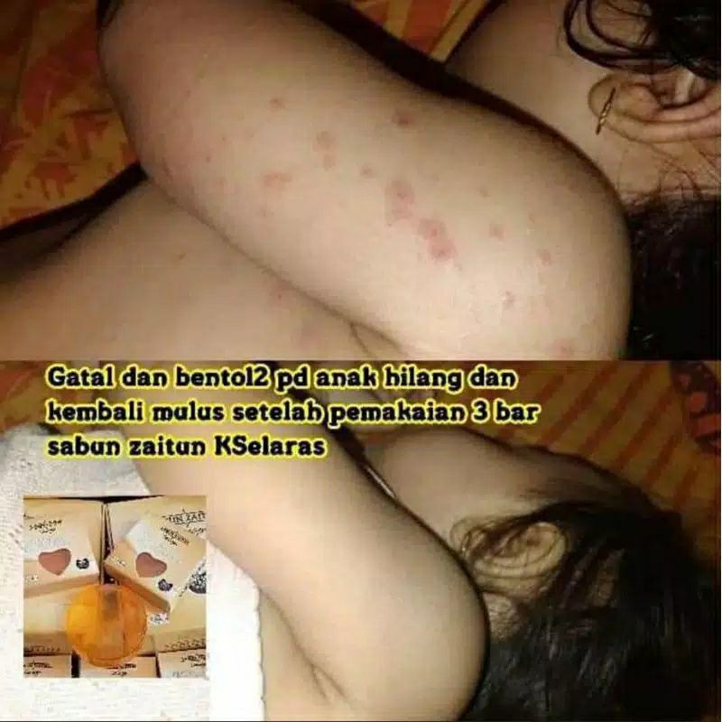

Sabun Zaitun Collagen
