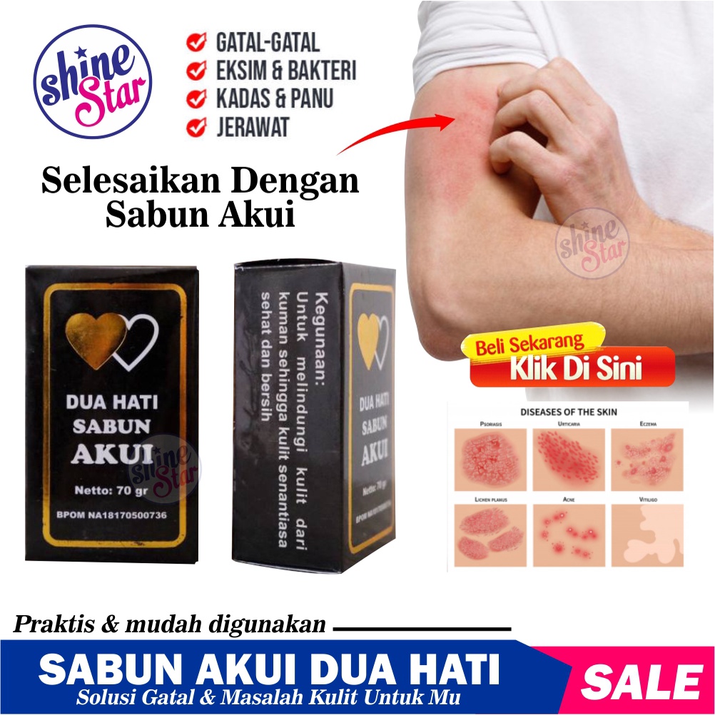 Jual Shine Star Bisa Cod Sabun Sulfur Belerang Sabun Belerang