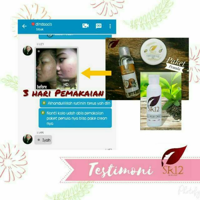 PAKET PEMULA SR12/ KULIT BERMINYAK /JERAWAT /BRUNTUS/ SENSITIF / MENCERAHKAN/MENYEHATKAN