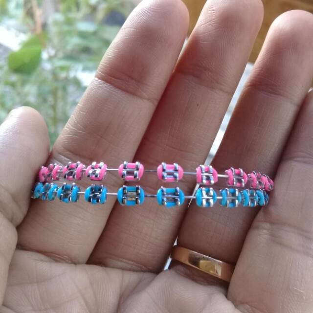 Behel lepas pasang