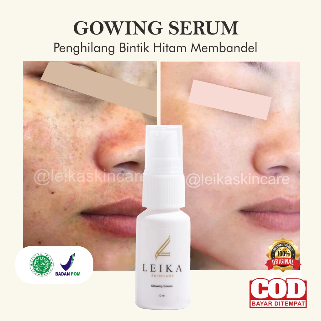 AMPUH Serum Penghilang Bintik Flek Hitam Di Wajah Membandel Menahun Perawatan Serum Bintik Hitam Ter