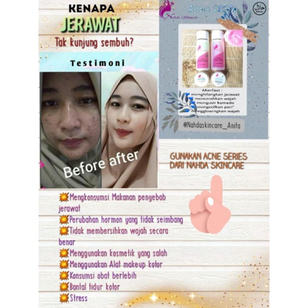 BAYAR DITEMPAT || NAHDA SKINCARE ORIGINAL 100% ORIGINAL || FREE BONUS MENARIK !!-7