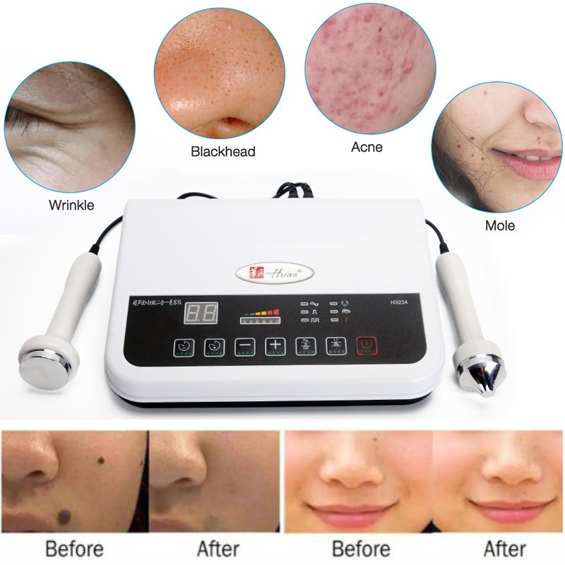 Alat Detox Wajah Ultrasound Kantung Mata Soft Cauter Laser Penghilang Flek Kutil Tai Lalat