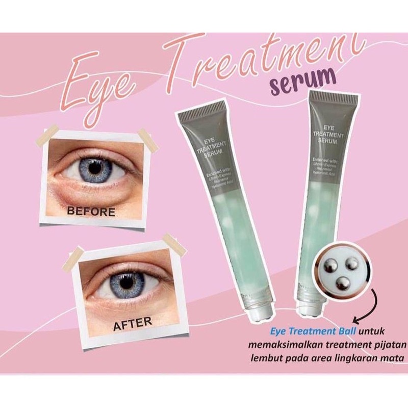 MS GLOW EYE TREATMENT SERUM / MS GLOW EYE SERUM / serum mata ms glow / eye serum msglow