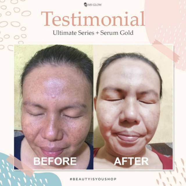 Ms Glow Serum Whitening Gold Original
