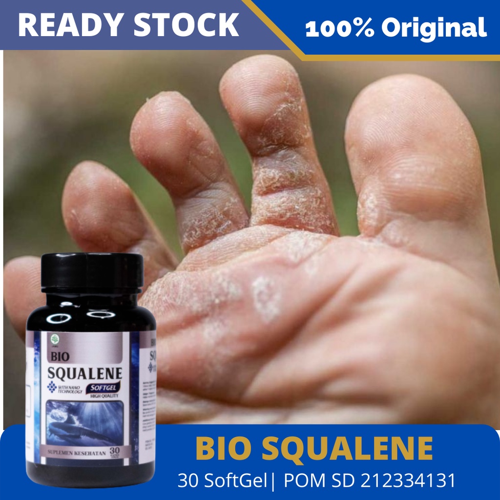 Obat Penghilang Kutu Air - Kutu Air di Kaki, Kutu Air di Tangan, Infeksi Jamur, Infeksi Kulit, Tinea Pedis, Gatal-Gatal, Melanoma, Kanker Kulit, Herpes, Gatal Pada Telapak Kaki, Kaki Rayapan, Kaki Bau, Budug, Borok, Kudis - Bio Squalene