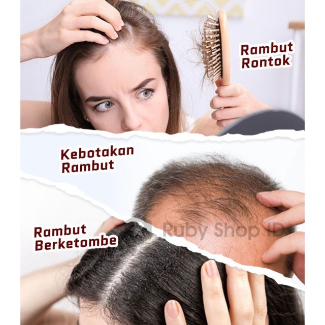 Shampoo Shampo Sampo JEVARINE Efektif All In One Hair Treatment Penumbuh Penyubur Rambut Botak Cepat Anti Ketombe dan Rontok Parah Atasi Kebotakan Bercabang Menghitamkan Memperkuat Akar Rambut Murah Ampuh BPOM 100% Original Best Seller