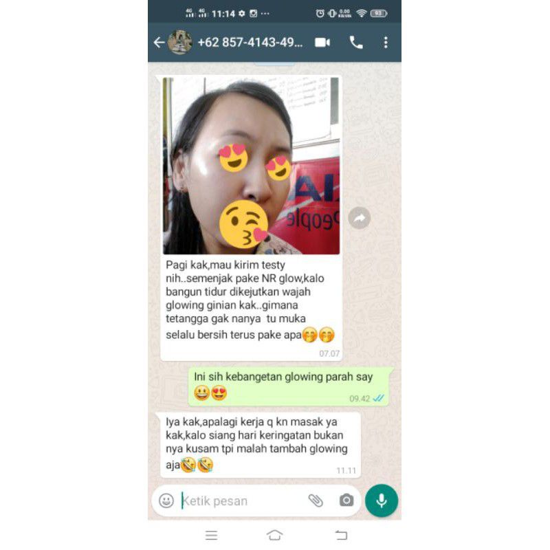 Nr Glow Paket Whitening Ultimate Terbukti Bikin Wajah Glowing - Rjnskin Glow Skincare Pemutih Wajah Cukup 1 Paket Wajah Sudah Glowing-5