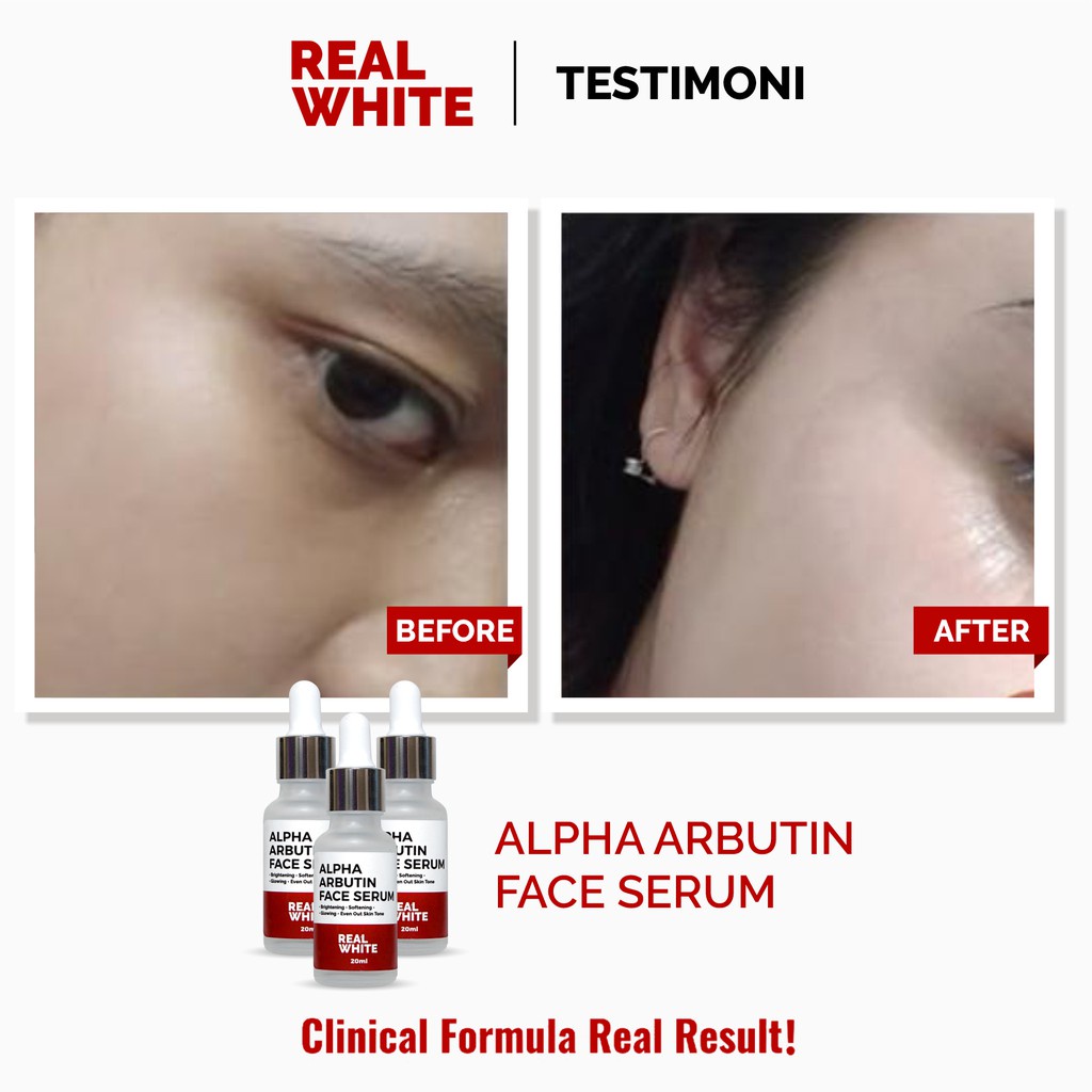 Real White Alpha Arbutin Serum 20ML BPOM