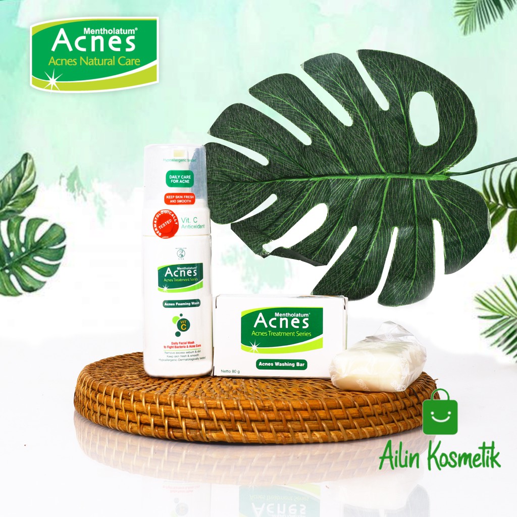 Acnes Treatment Series | Washing Bar 80gr | Foaming Wash 100ml | Powder Skincare Acnes By AILIN
