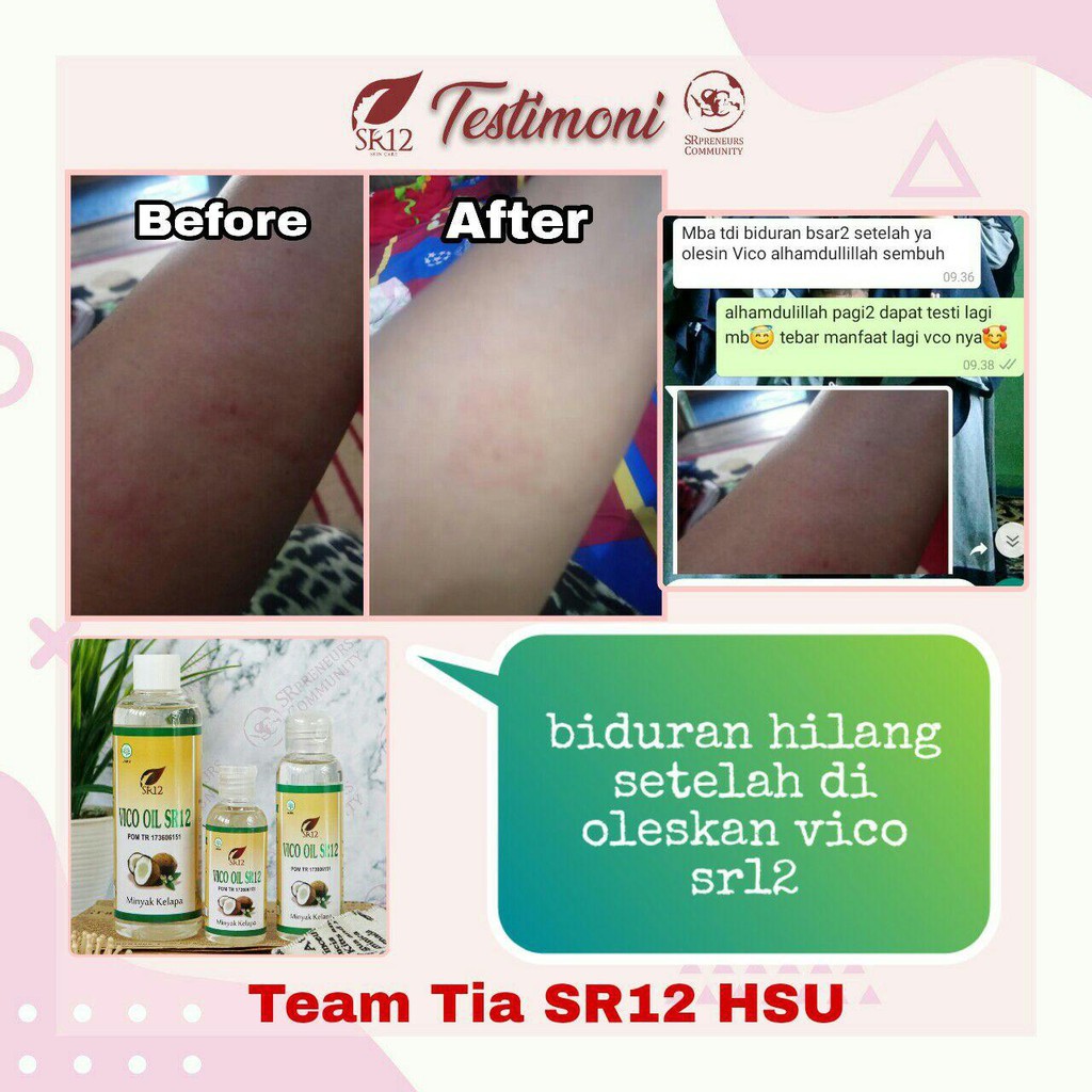 IMUN BOOSTER VCO MINYAK KELAPA MURNI SR12 / VICO VIRGIN COCONUT OIL 60ml / 100ml / 250ml / 60 Kapsul