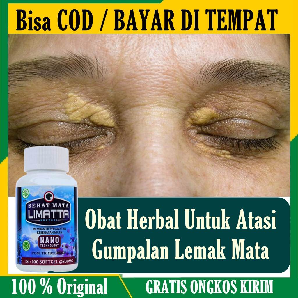 Jual Obat Alami Gumpalan Lemak Mata Obat Gumpalan Di Kelopak Mata