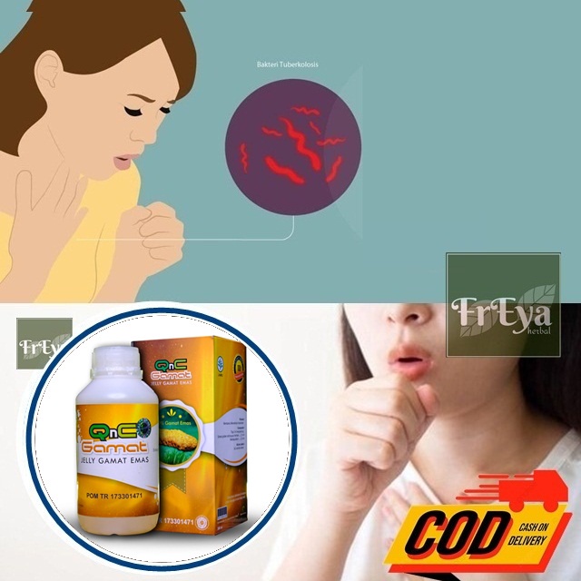 OBAT TBC KELENJAR, OBAT HERBAL TB KELENJAR, OBAT TUBERKULOSIS LIMFADENITIS (BISA COD)