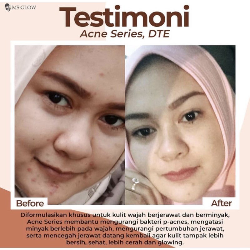 DEEP TREATMENT ESSENCE - DTE - MSGLOW