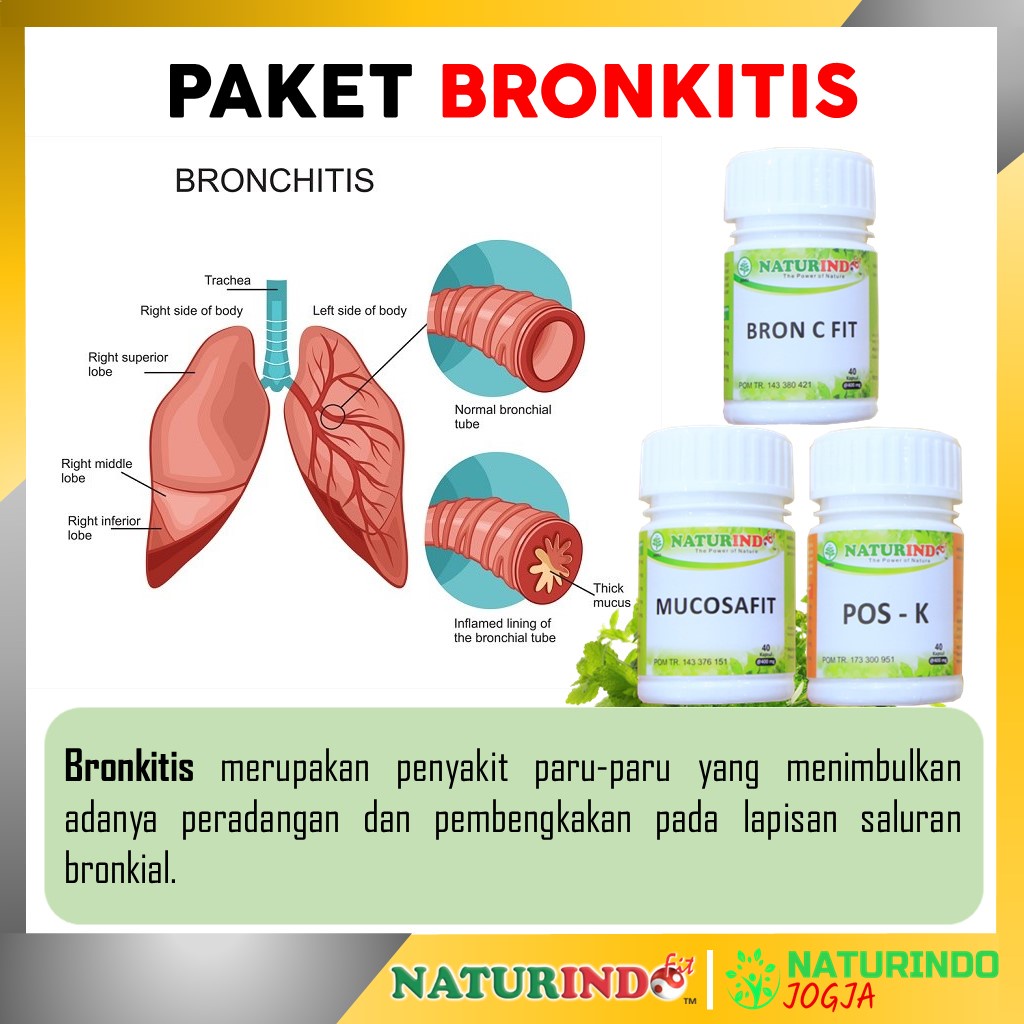 Obat Sesak Nafas Batuk Kering Berdahak Batuk Berlendir Alergi Dingin Debu Sinusitis Rhinitis Amandel Menaun Obat Asma Obat TBC Bronkitis Obat Jamu Herbal Sesak Nafas Obat Gangguan Pernafasan Alergi Debu Obat Gurah Paru Paru Bron C Fit Naturindo Yogyakarta-BRONKITIS