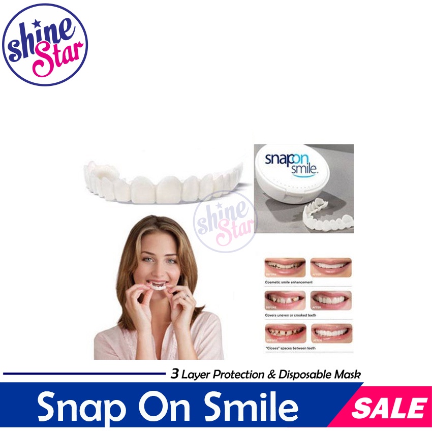 [ COD ] ORIGINAL 100% SNAP ON SMILE AUTHENTIC / GIGI PALSU SEPASANG ATAS BAWAH