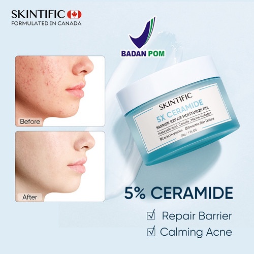 [30ml] Skintific 5X Ceramide Barrier Repair Moisturize Gel