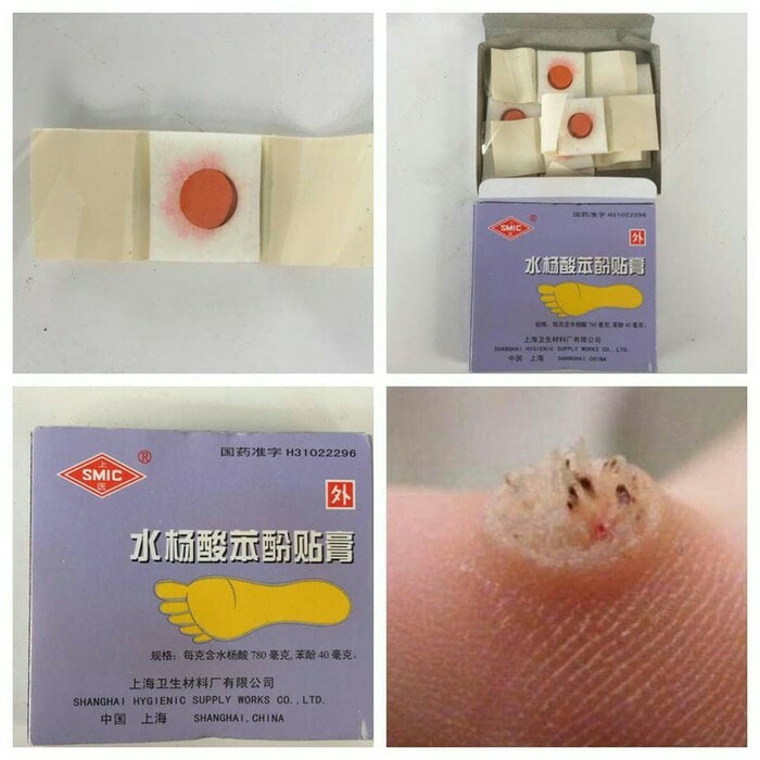 ORIGINAL Obat Mata Ikan / Obat Kutil / Obat Kapalan dll Ji Yan Gao